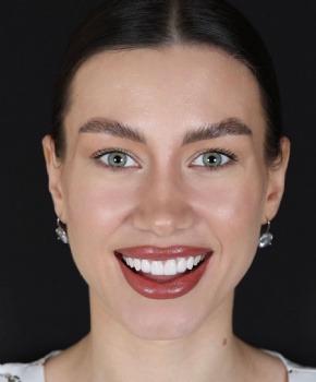 case-Hainan Meierkang Biomedical Industry Development Co., Ltd